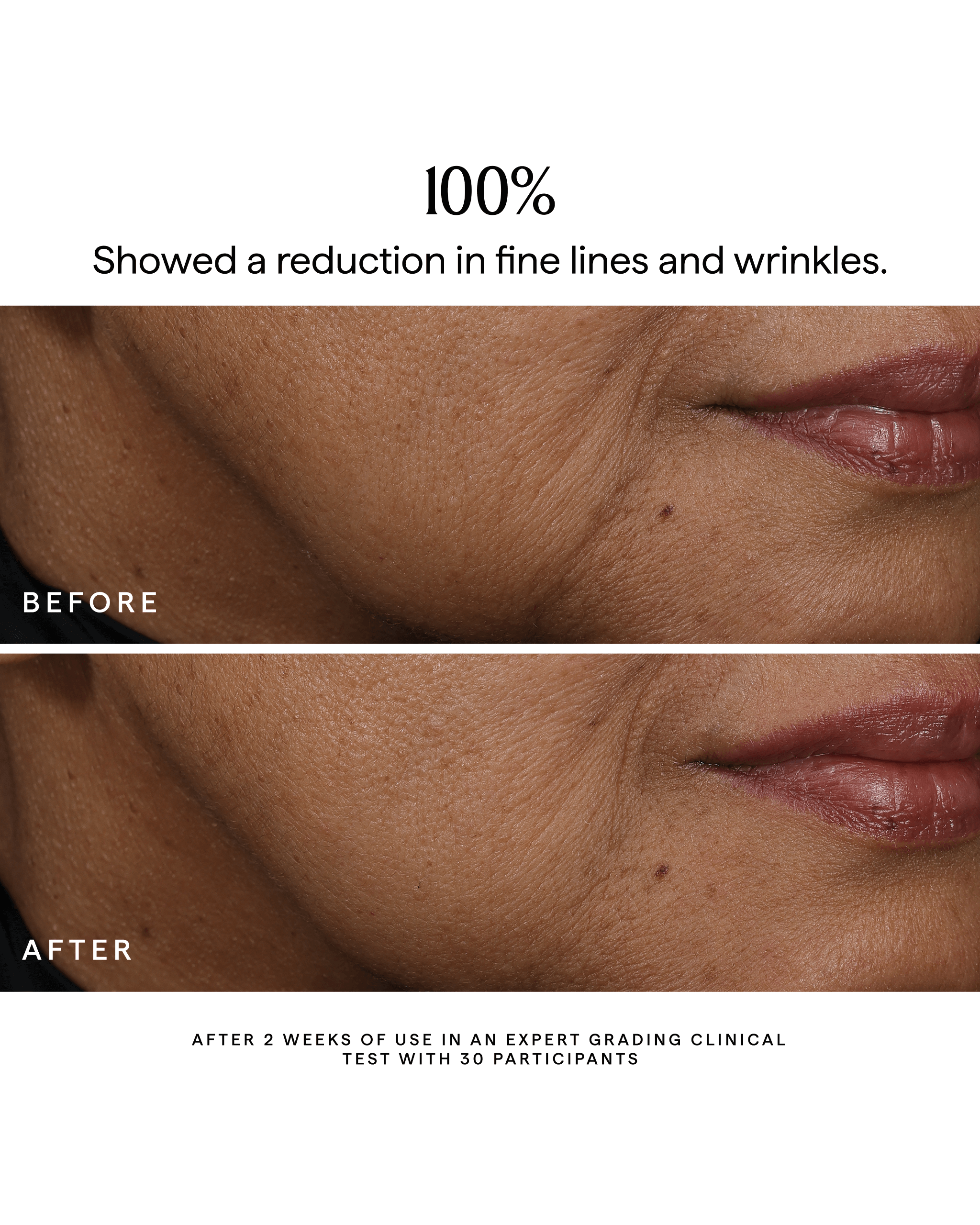 herbivore-bakuchiol-dual-gesichtsserum-retinol-alternative-30ml image 6